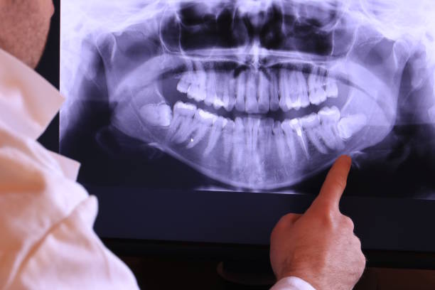Best Emergency Denture Repair in Keshore, LA