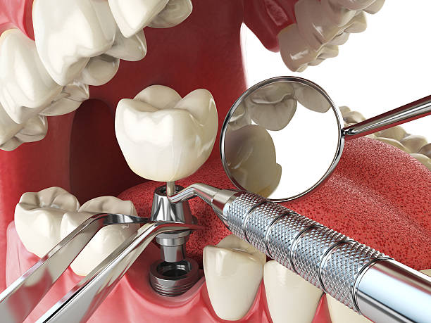 Best Emergency Treatment for Jaw Pain or Injury in Keshore, LA